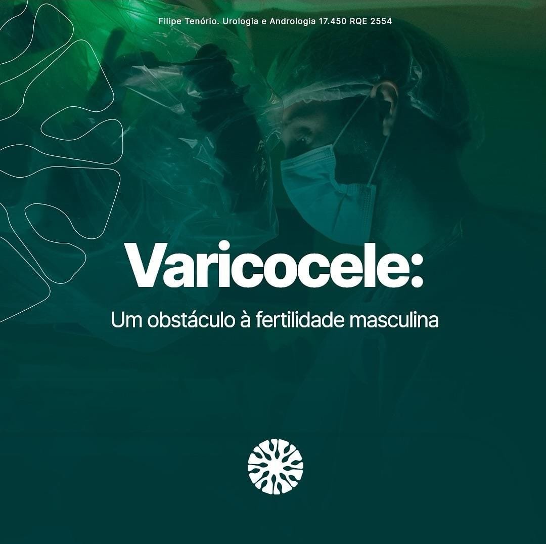 Varicocele